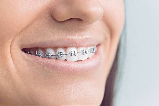 Best Dental Inlays and Onlays  in Hickory Hls, IL